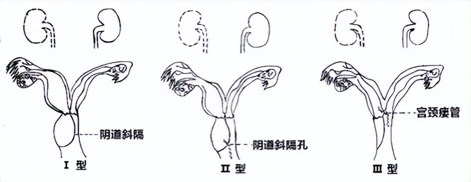 百家号:澳门一码一肖一特一中，详细解答、精准解答解释落实